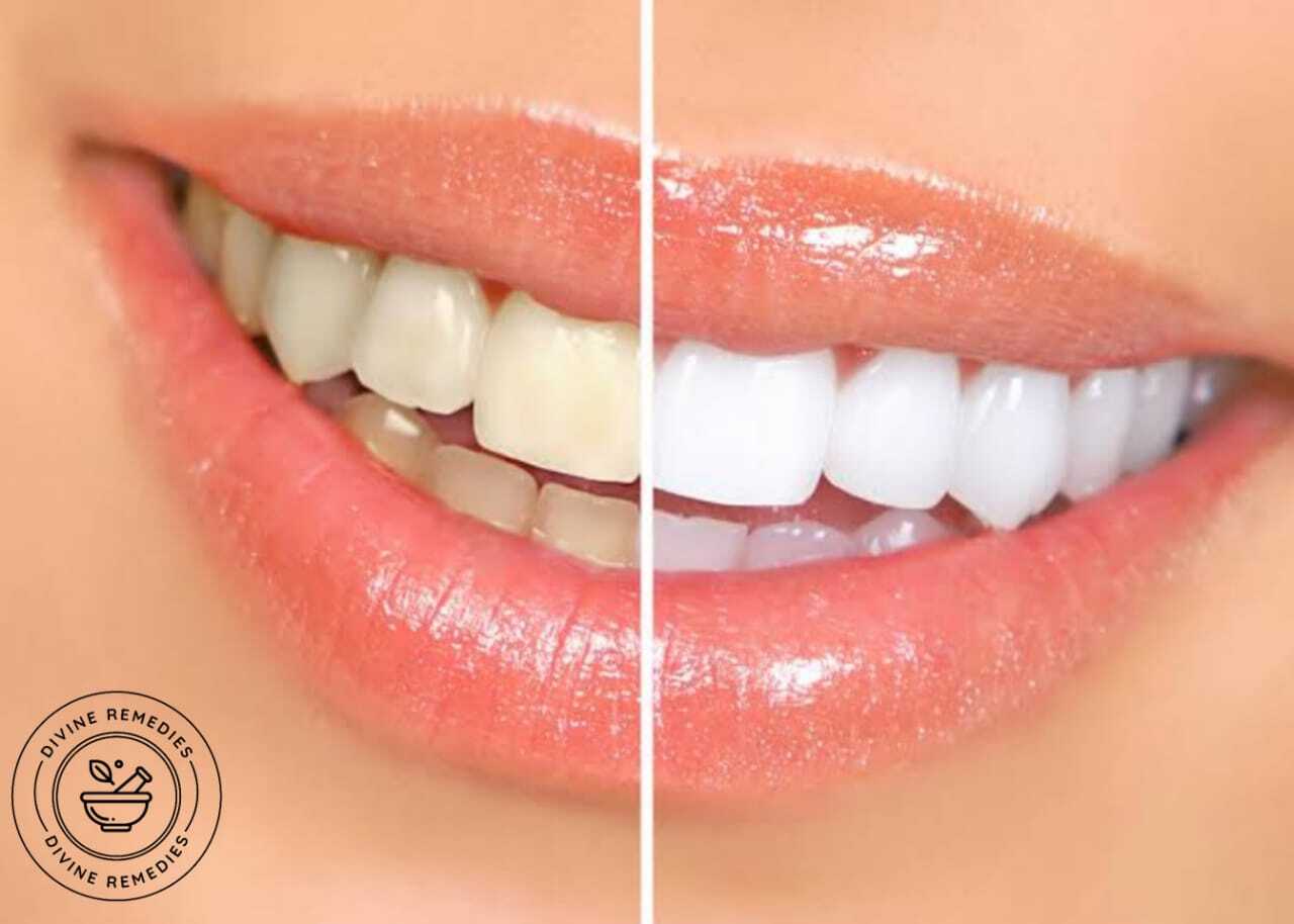 Turmeric Teeth Whitner