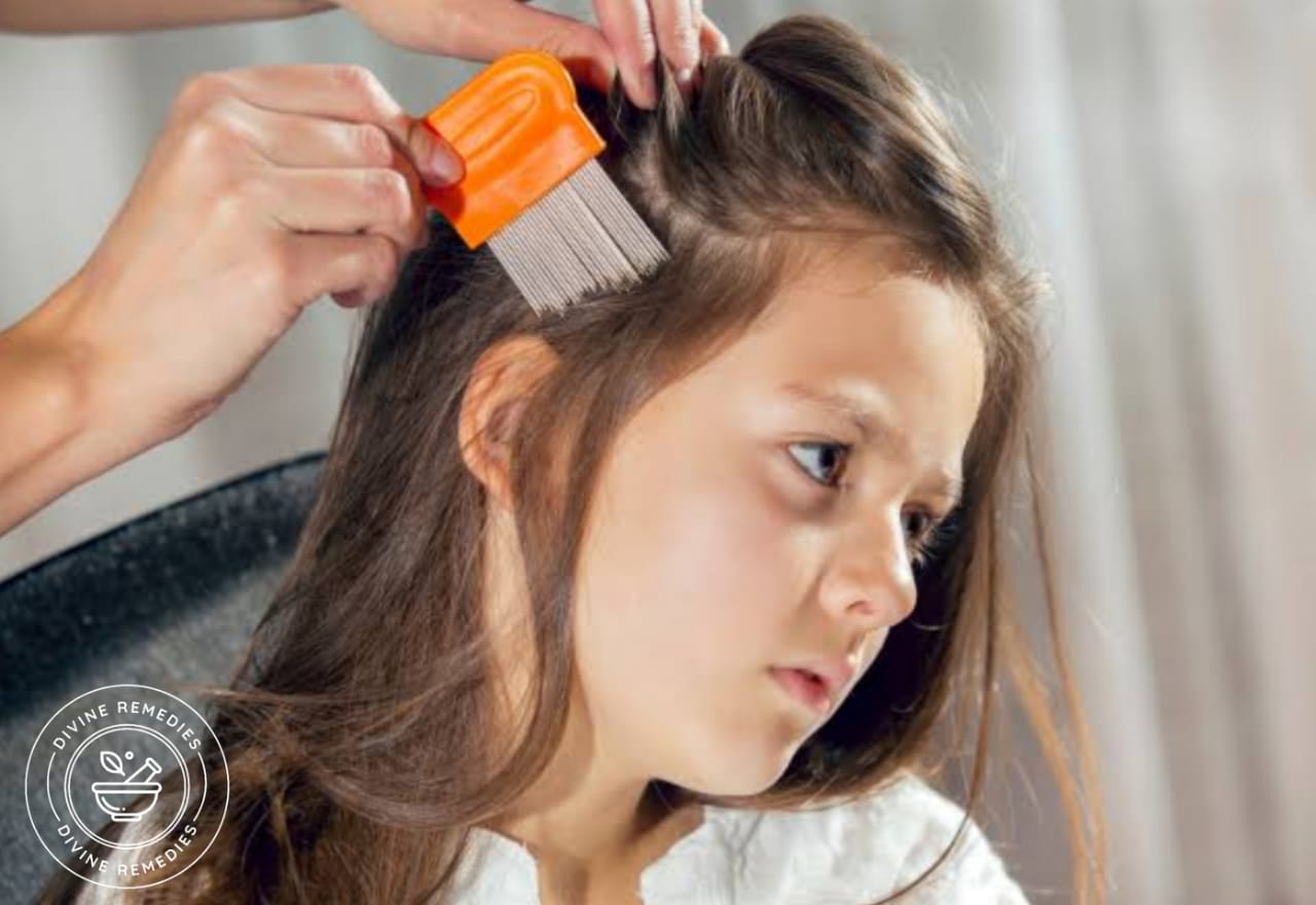 Treat Lice Quickly